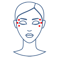 Kraaienpootjes - Esthetiek