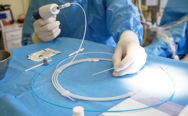 Endoveneuze lijmbehandeling