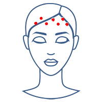 Voorhoofd - Esthetiek